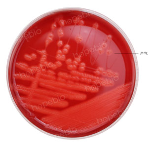 血平板-�a�馇v膜梭菌